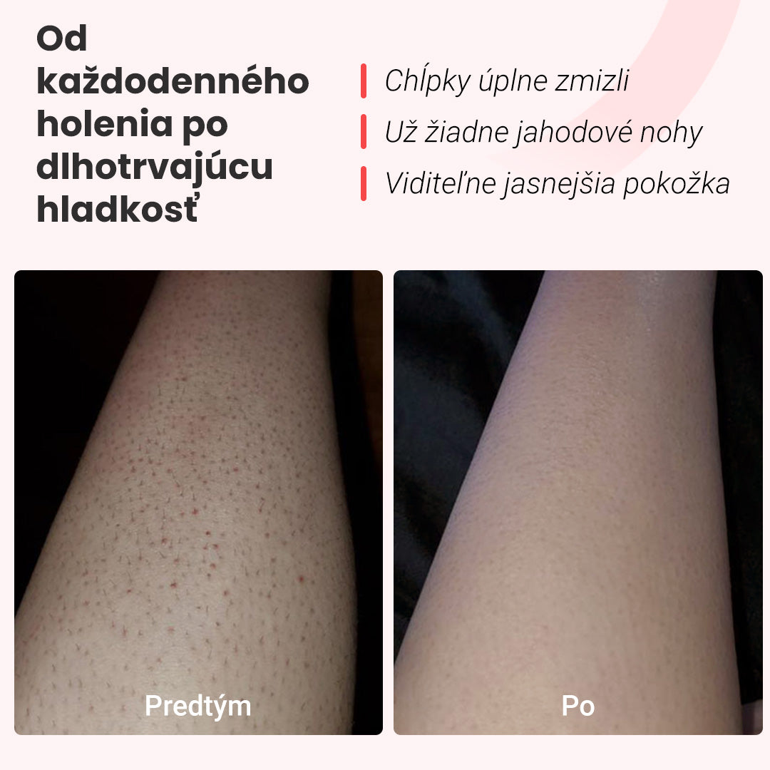 IPL epilátor Hilda