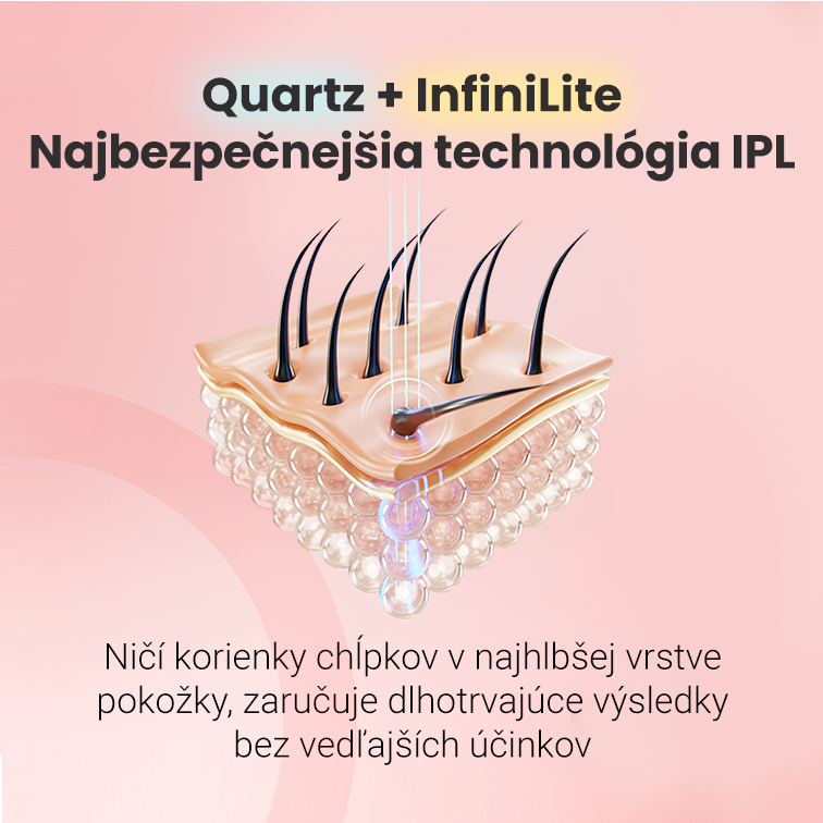 IPL epilátor Hilda